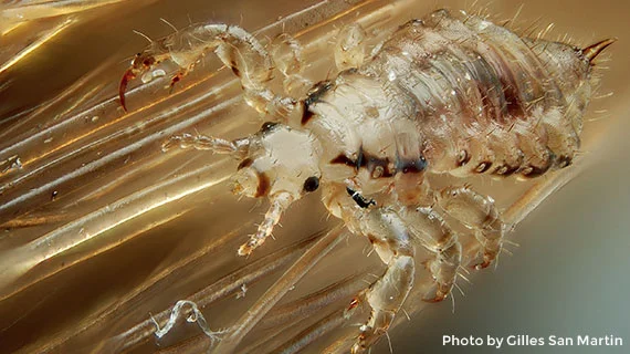 Super Lice Are Real - And There is Only One Way to Get Rid of Them